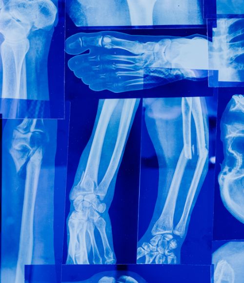 The Orthopedic Center